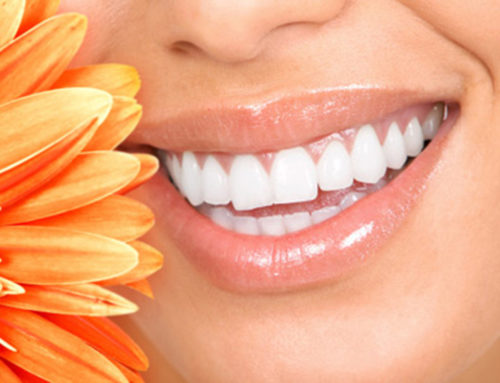 16% Carbamide Peroxide Teeth Whitening Gel by Prowhitesmile