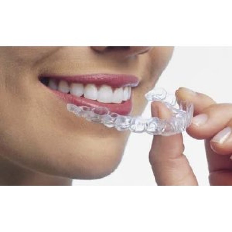 Best ProWhite Smile Whitening Kits UK Teeth Whitening