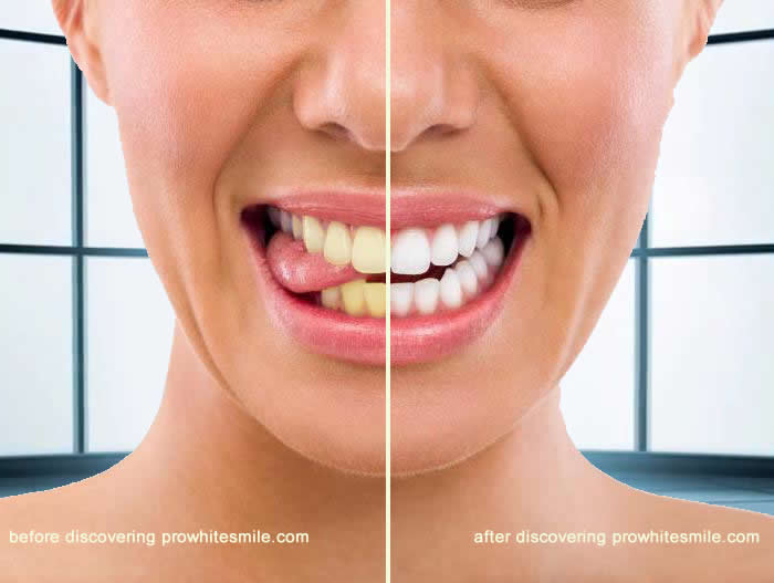 Dicover the Best Products For White Teeth