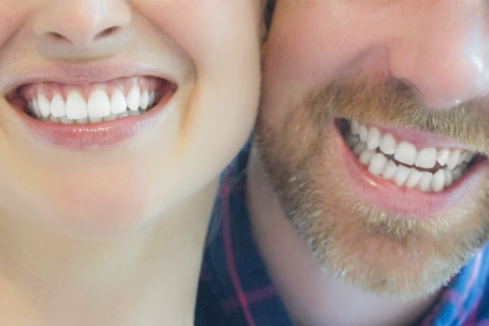 Buy Opalescence Teeth Whitening Products at ProWhiteSmile