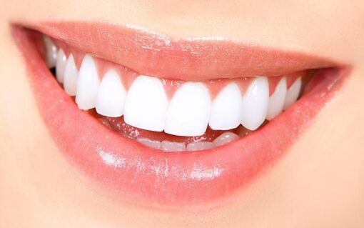 ProWhiteSmile Teeth Whitening Tray and Cases