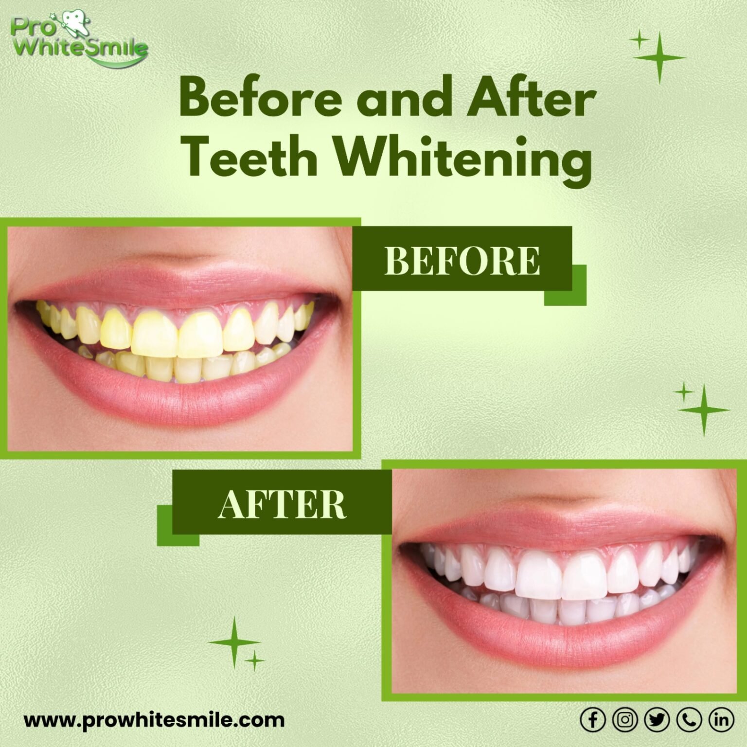 Real life experiences before and after teeth whitening: See The Great ...