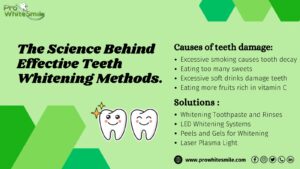 Teeth Whitening Methods