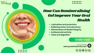 Remineralising gel