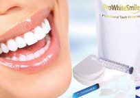 prowhitesmile home teeth whitening kit